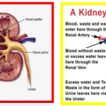 mencegah gagal ginjal